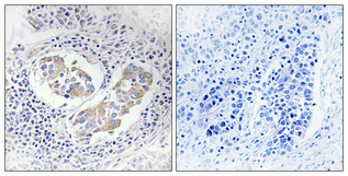 IHC - Aldose Reductase Polyclonal Antibody AP68377